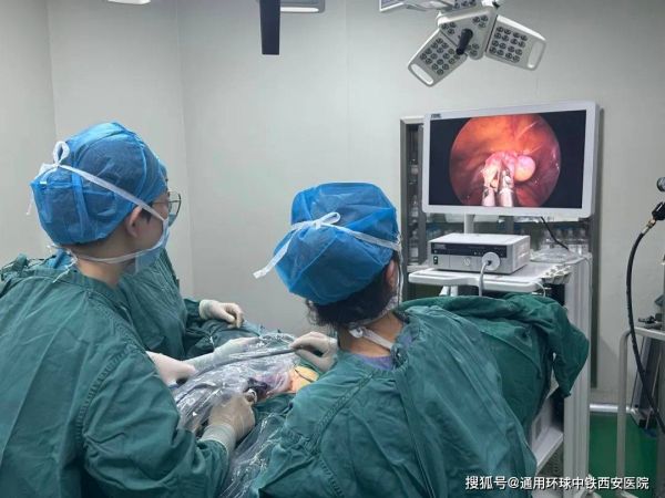 经脐单孔腹腔镜——输卵管切除术后不留痕，患者：还有这种事？